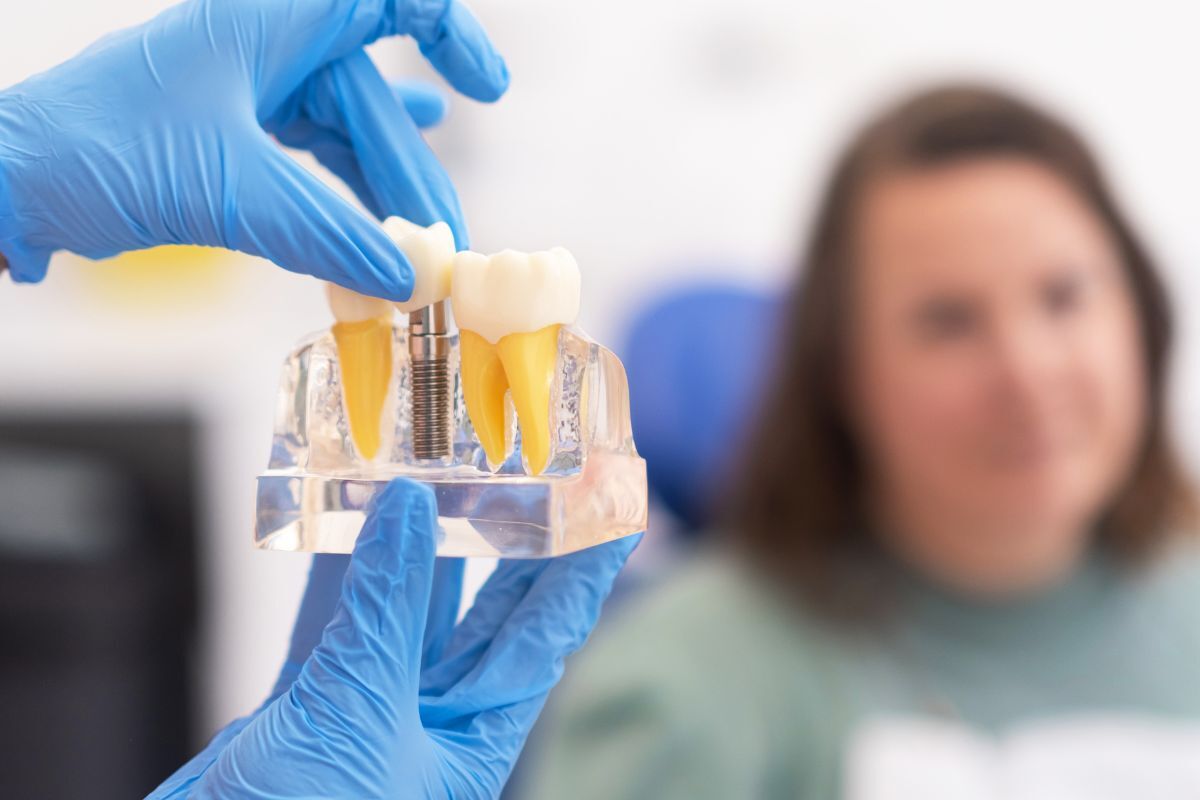 Featured image for “Missing Teeth? Discover Why Dental Implants Are The Most Natural, Permanent Solution”