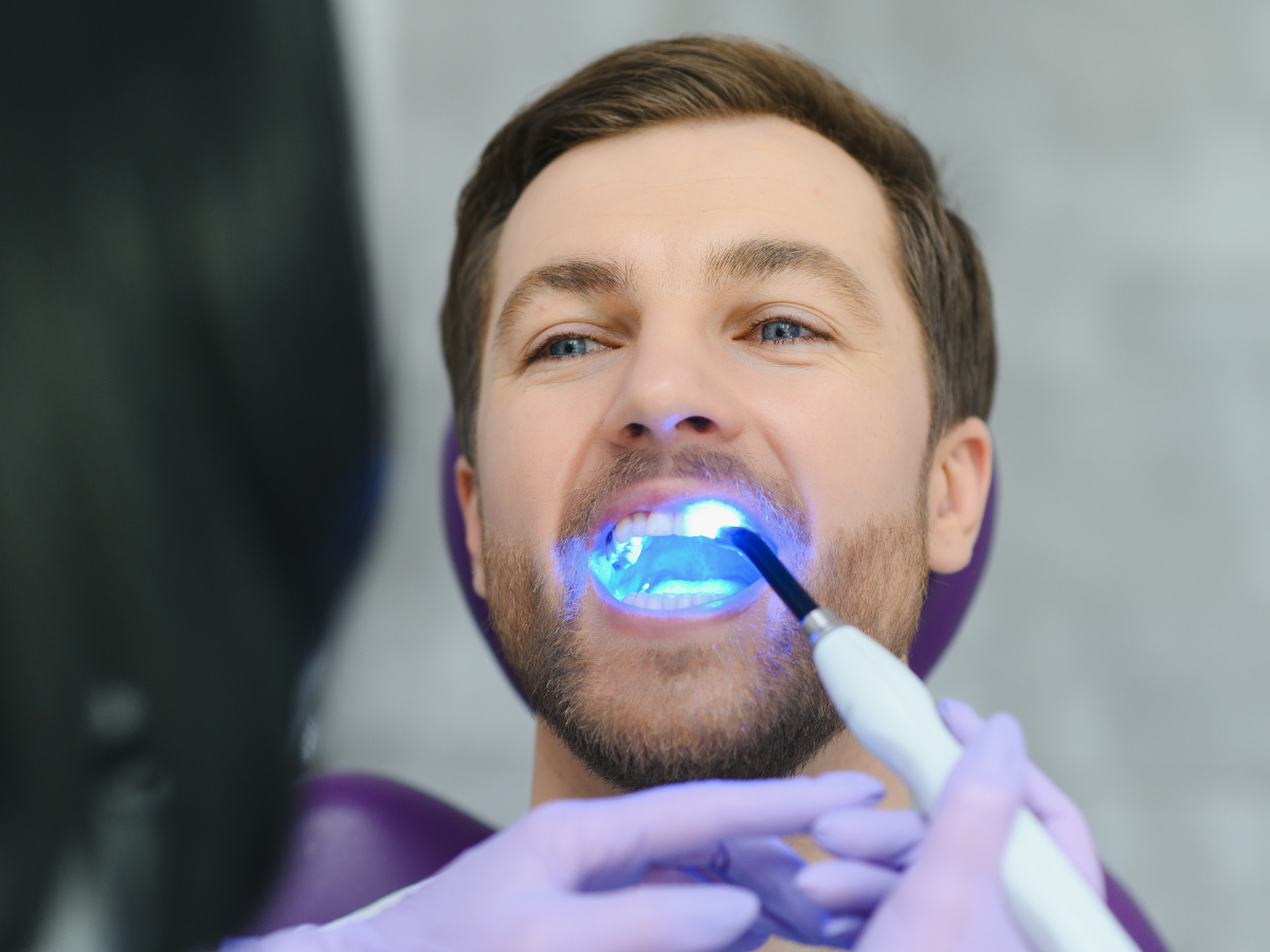 Featured image for “Professional Teeth Whitening vs. At-Home Kits: What Eugene Patients Should Know Before Brightening Their Smile”